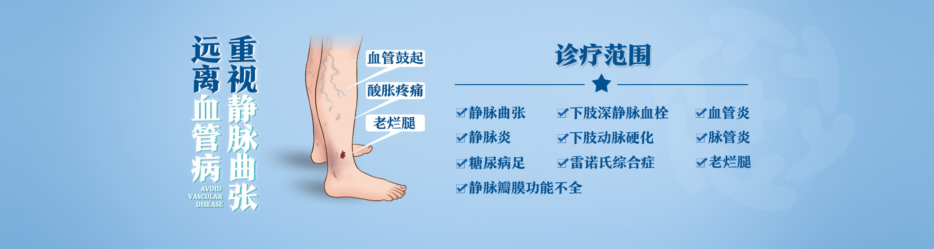 重视静脉曲张，远离血管病