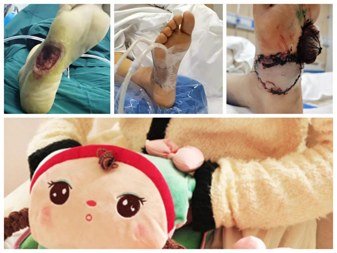 居家隔离如何预防生活伤！文中图片可能会引起不适，请谨慎点开！