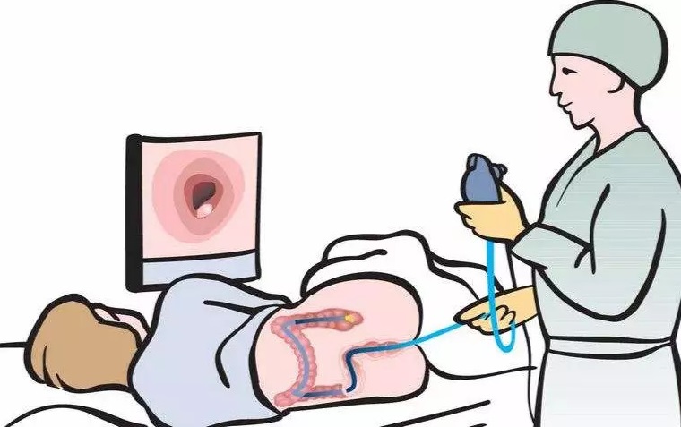 做肠镜之前需要准备什么？看完就明白了~