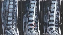 不到30岁就腰椎间盘突出了! 当代年轻人的身体状况哪里出了差错？