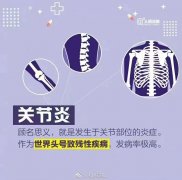 天冷如何预防关节炎？​